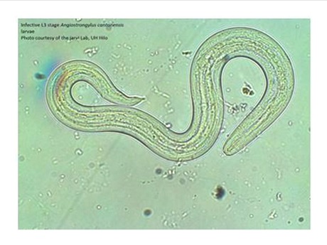 rat lungworm virus